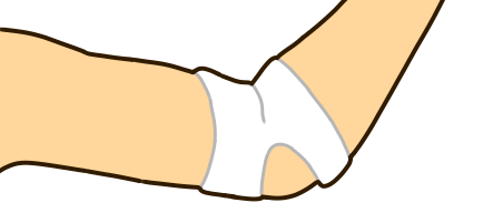 肘の痛みのイラスト