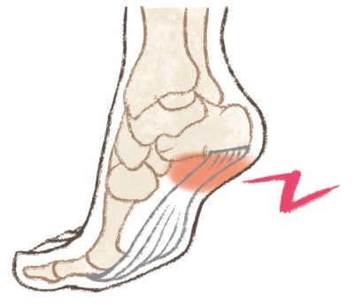 かかとの痛みのイラスト