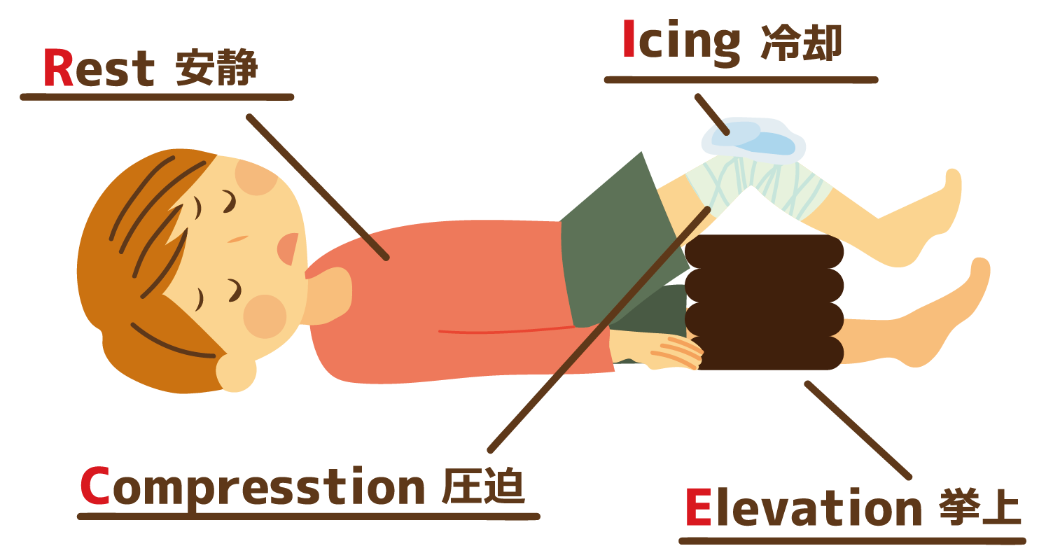 RICE処置のイラスト
